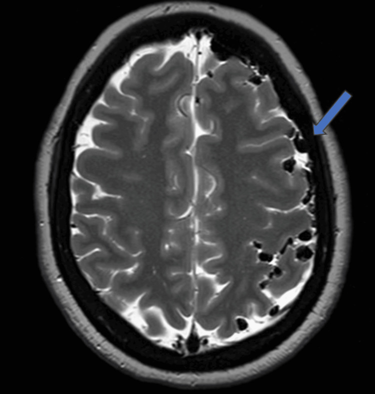 Figure 7