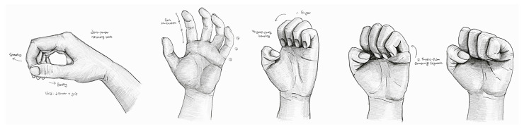 Figure 25