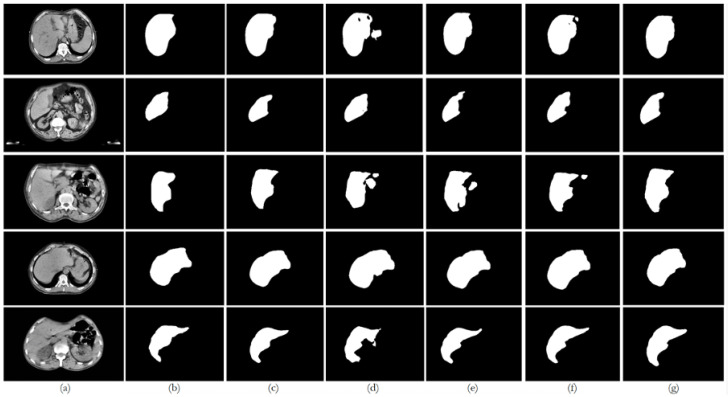 Figure 14