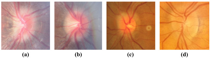 Figure 15