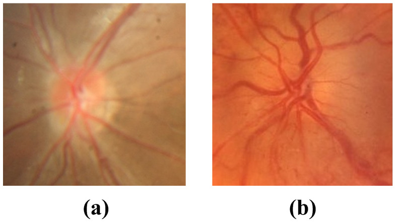 Figure 16