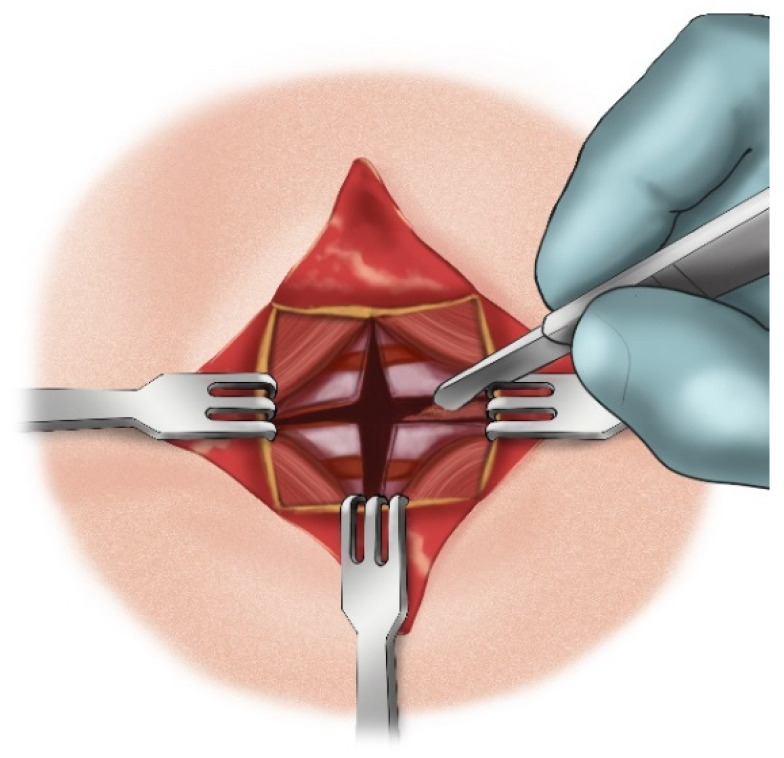 Figure 14