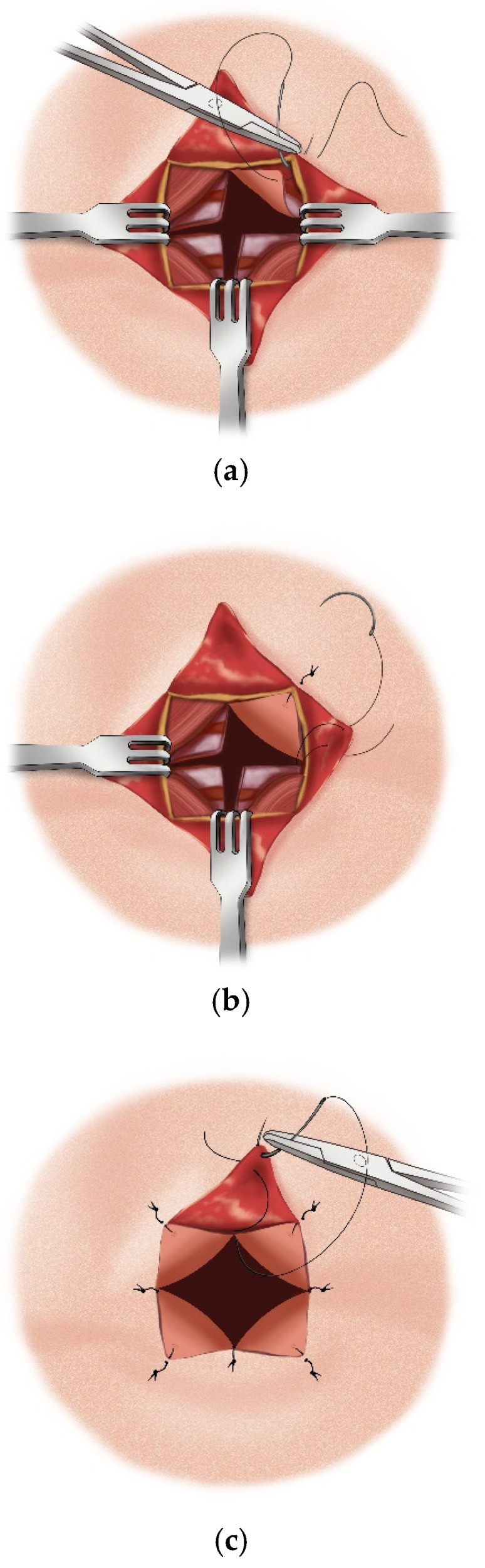 Figure 15