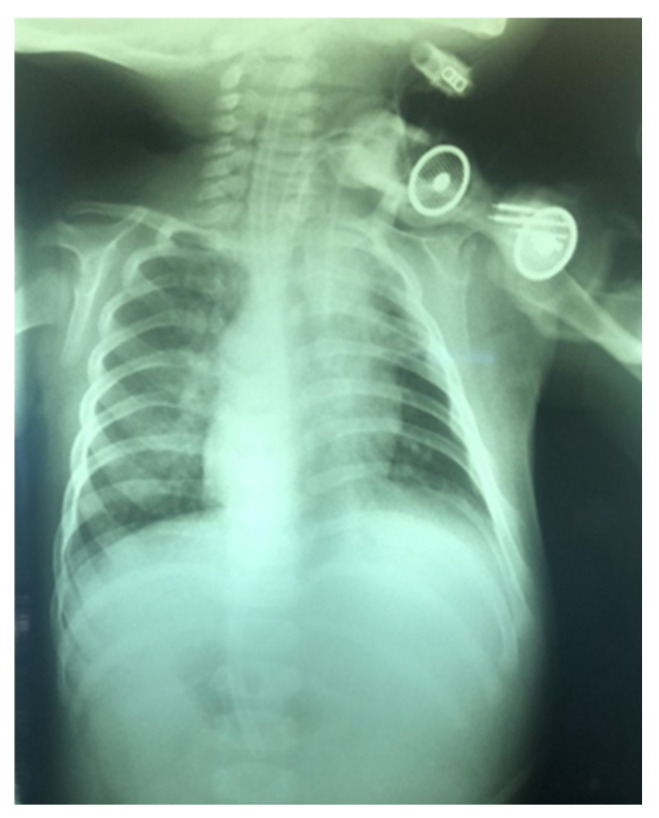 Figure 16