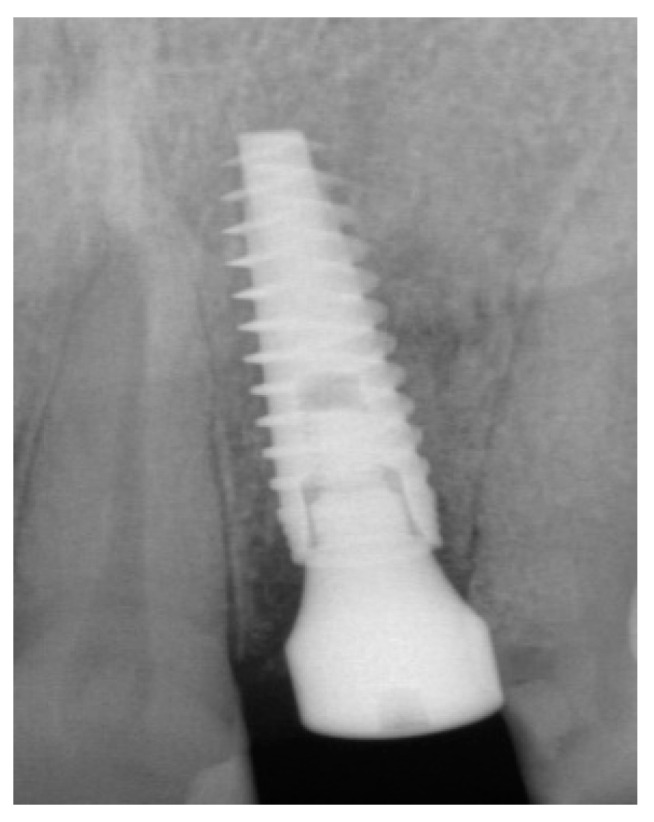 Figure 10