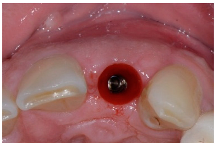 Figure 11