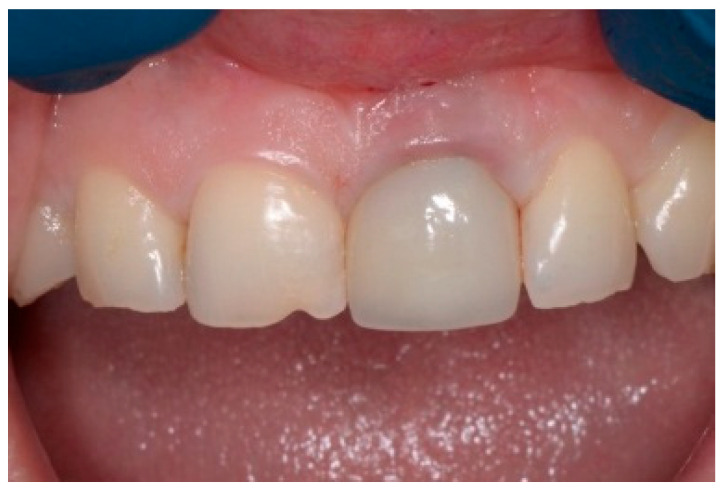 Figure 13