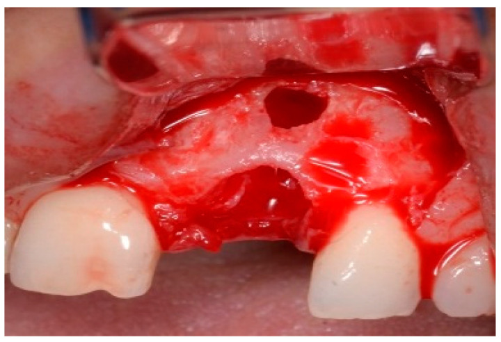 Figure 14