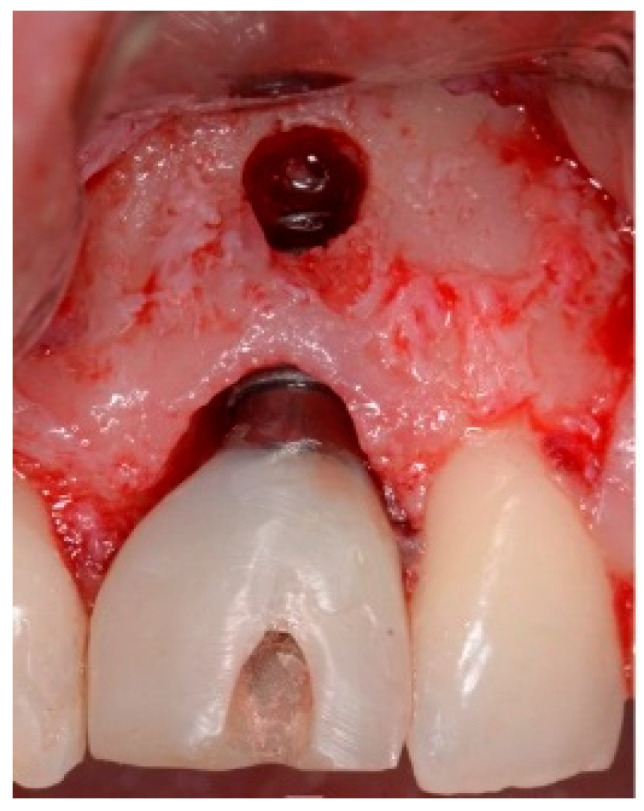 Figure 15