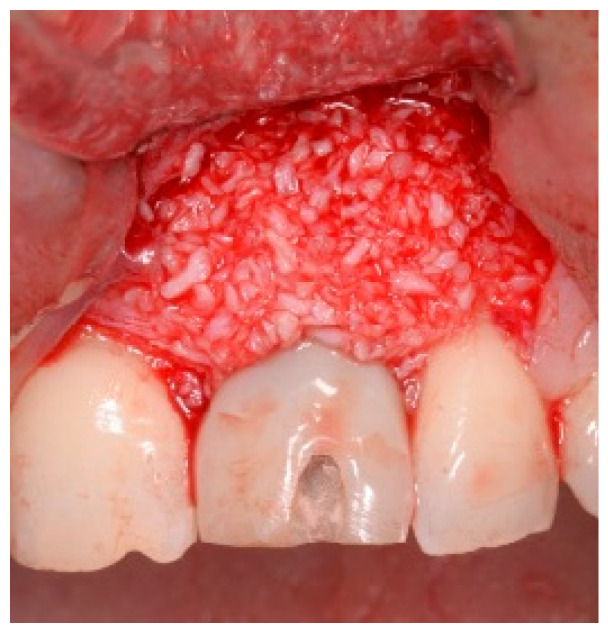 Figure 16