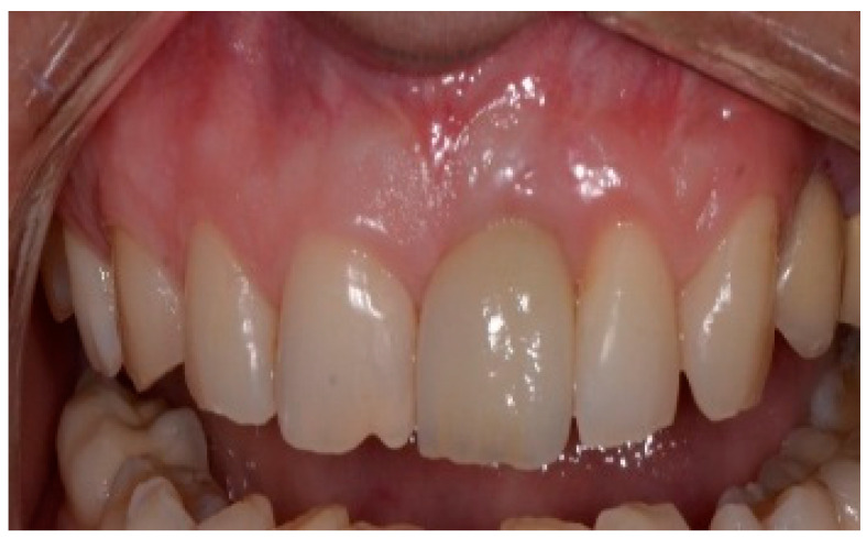 Figure 17