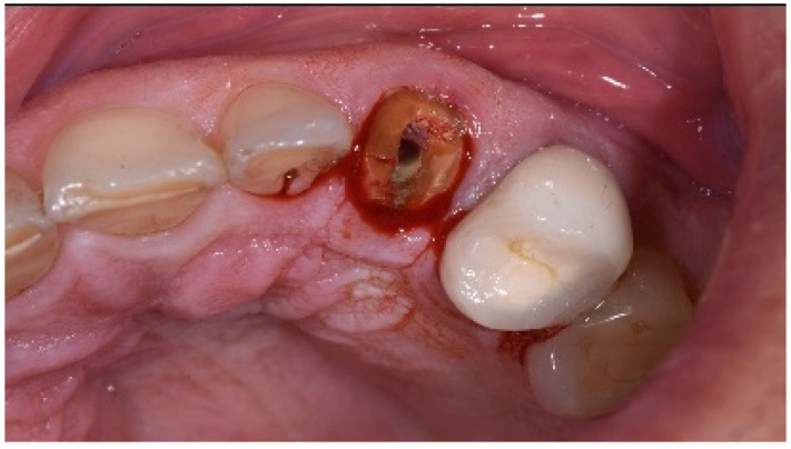 Figure 18
