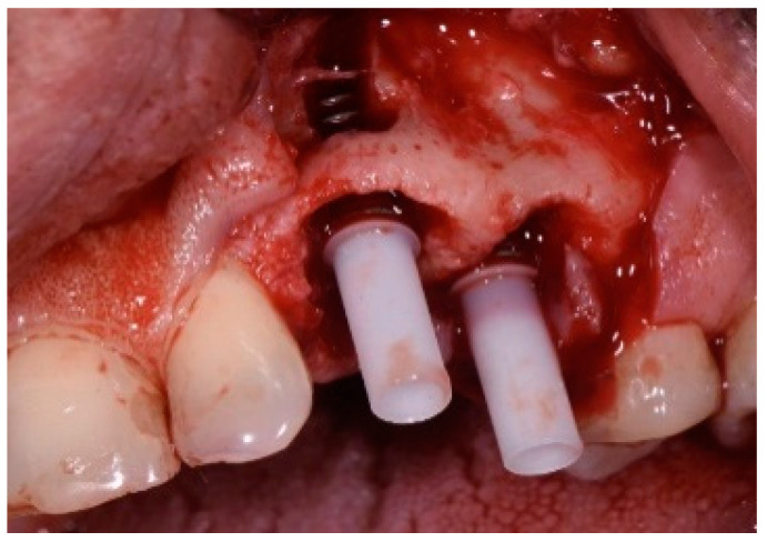 Figure 19