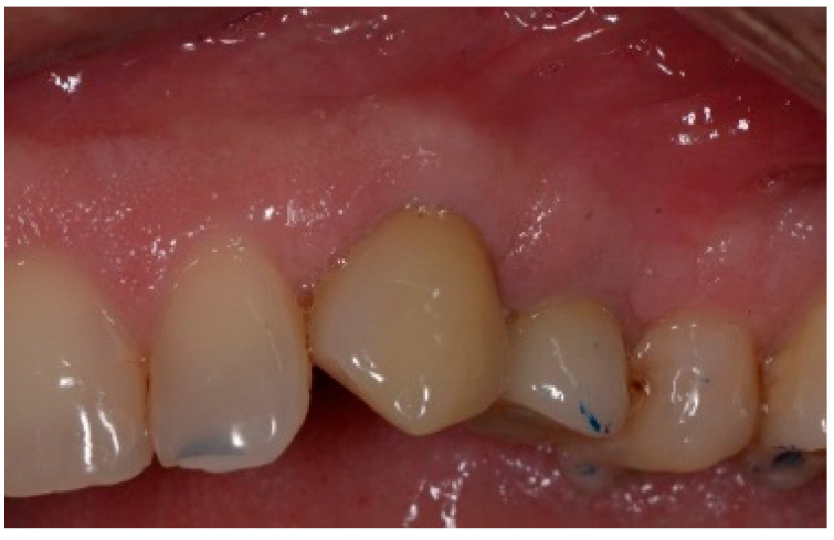 Figure 20