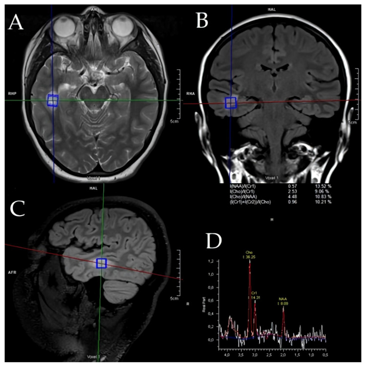 Figure 2
