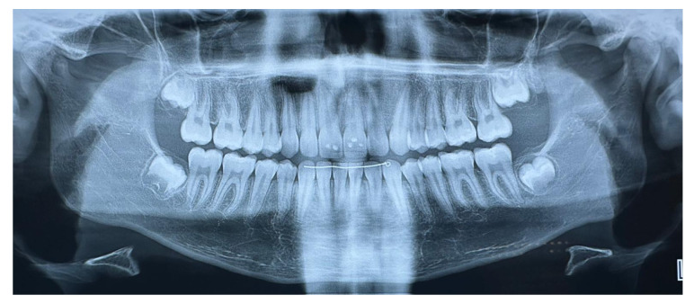 Figure 9