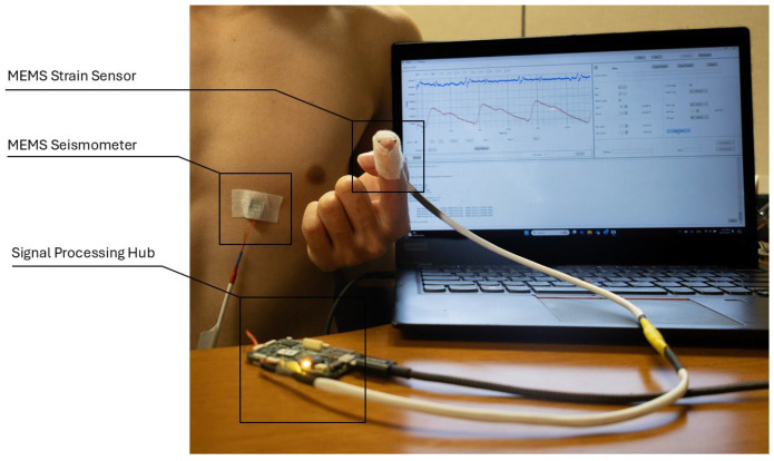 Figure 9