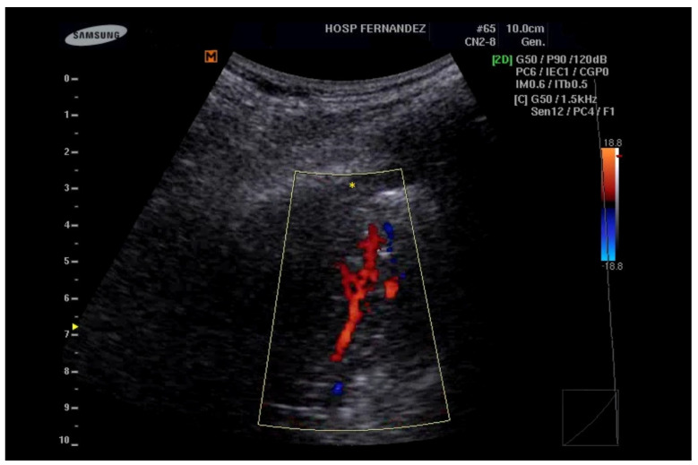 Figure 4