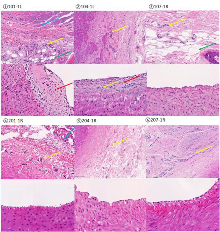 Fig 14