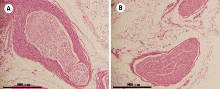 Fig 16