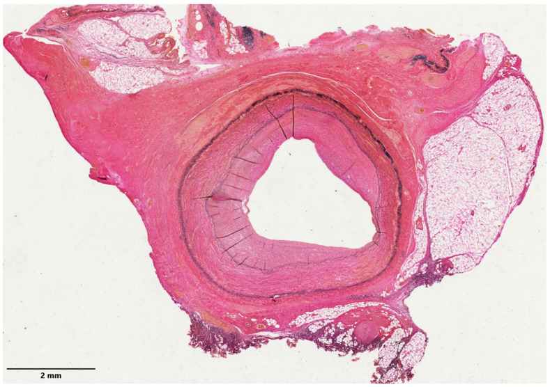 Figure 13