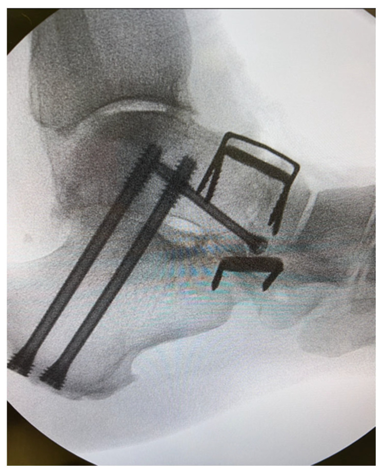 Figure 5