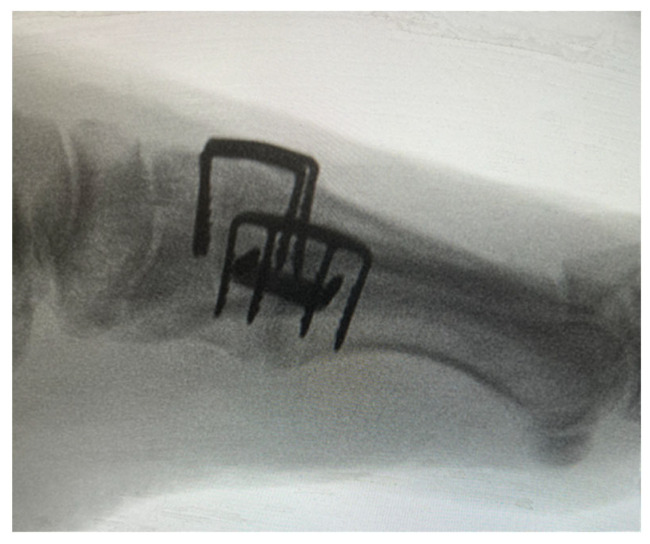 Figure 7