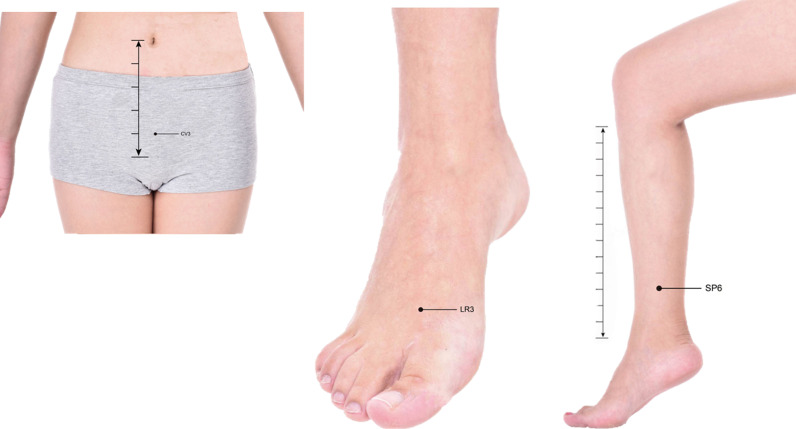 Fig 3