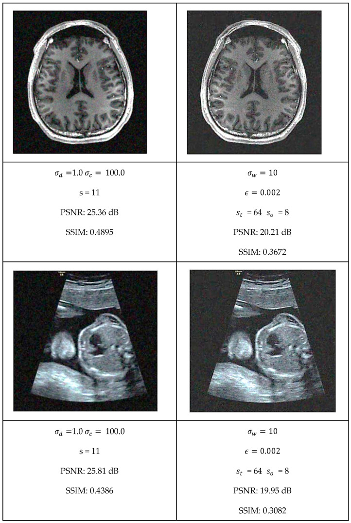 Figure 18