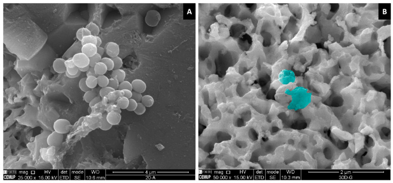 Figure 11