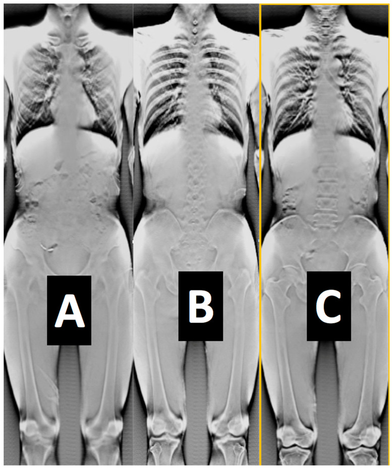 Figure 11