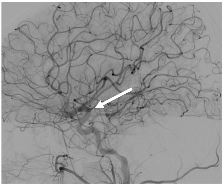 Figure 12