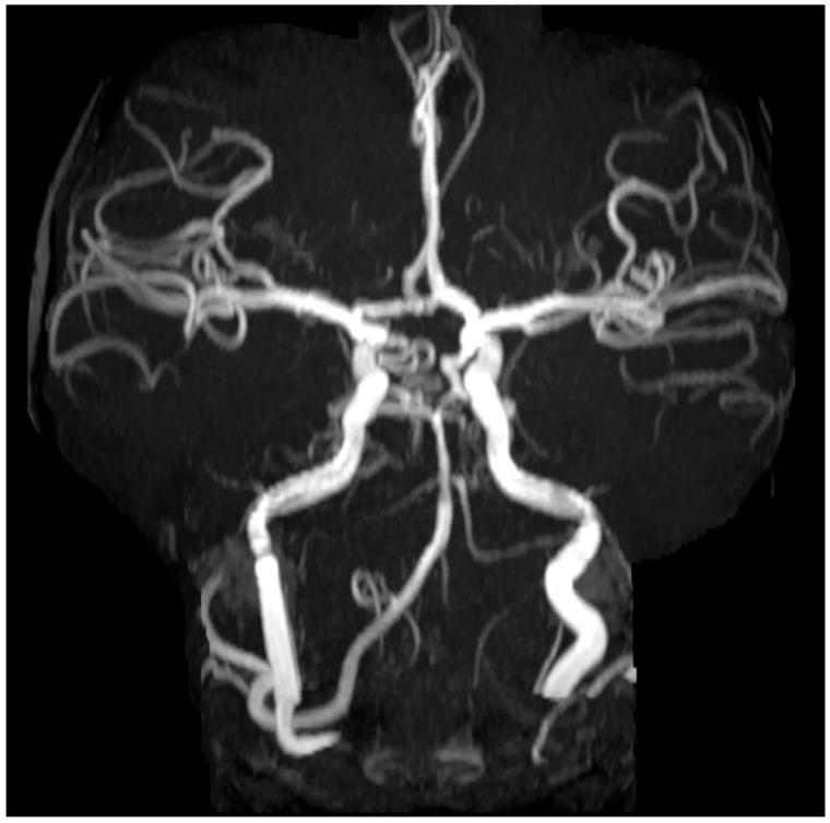 Figure 13