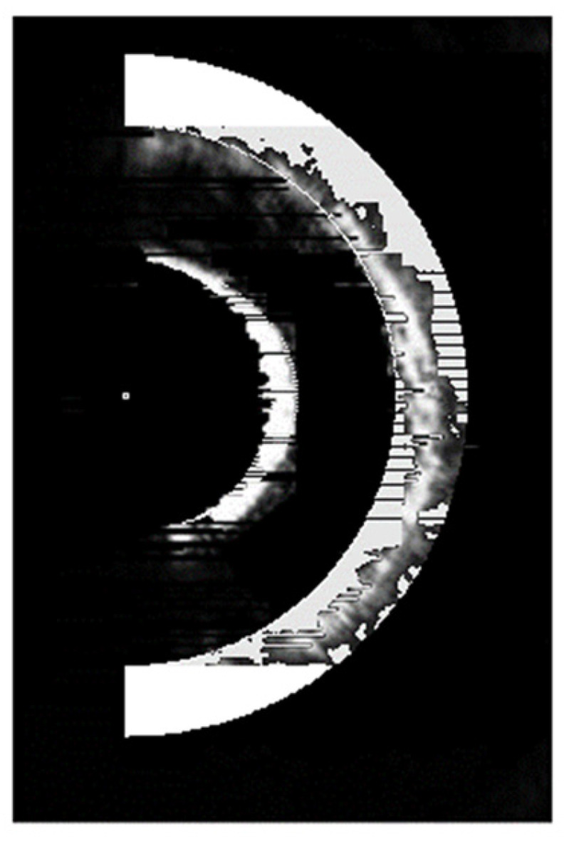 Figure 17
