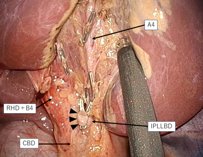 FIGURE 4
