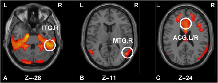 FIGURE 1