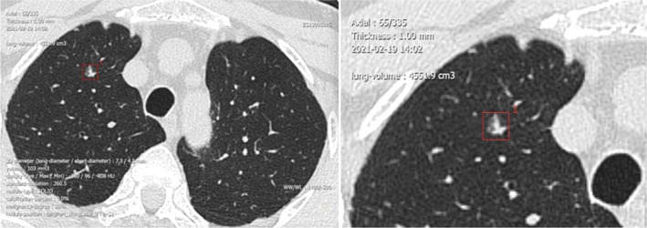 FIGURE 1