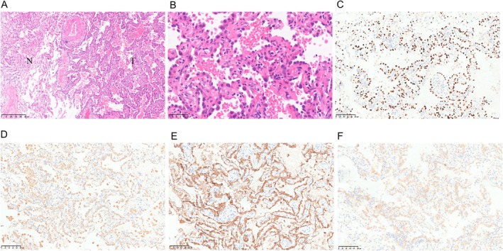 FIGURE 3