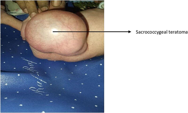 Figure 2