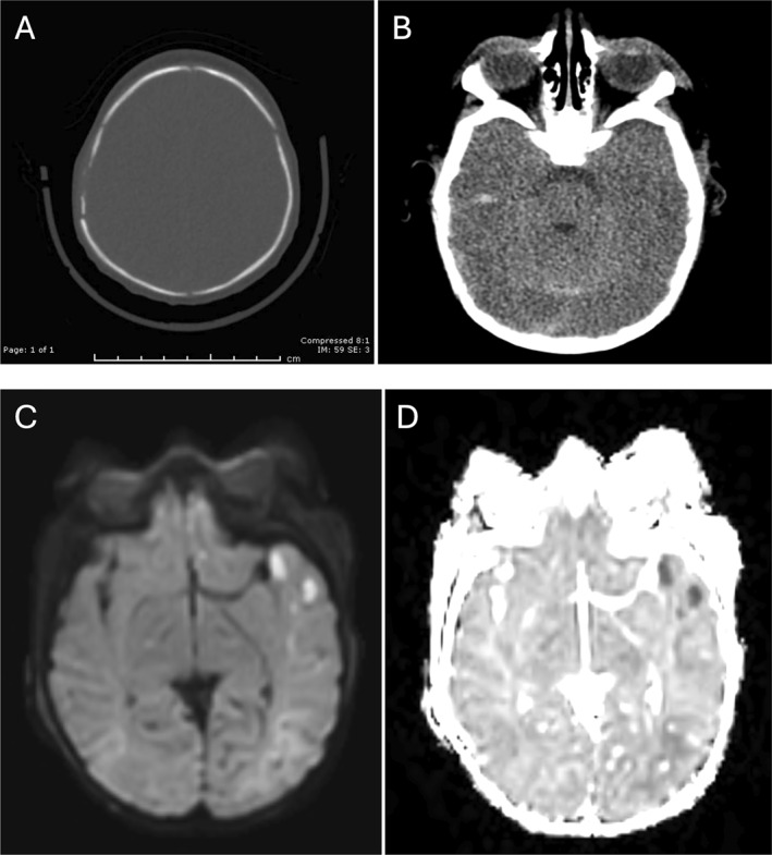FIGURE 3