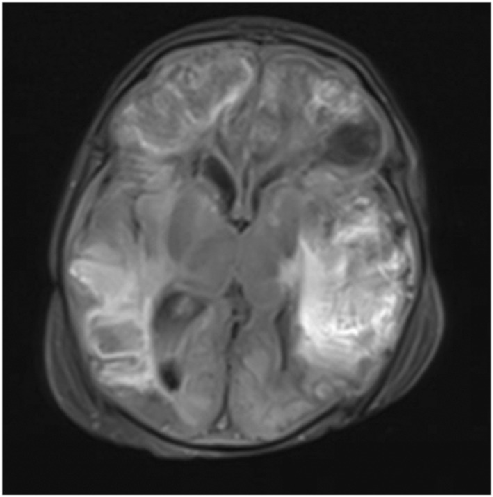 FIGURE 1