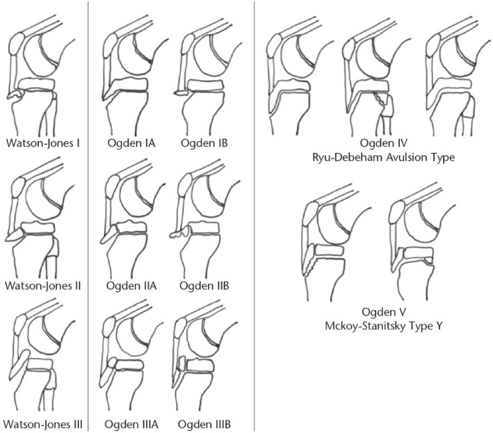 FIGURE 3