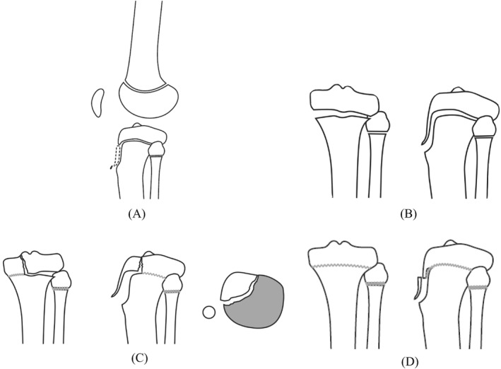 FIGURE 4