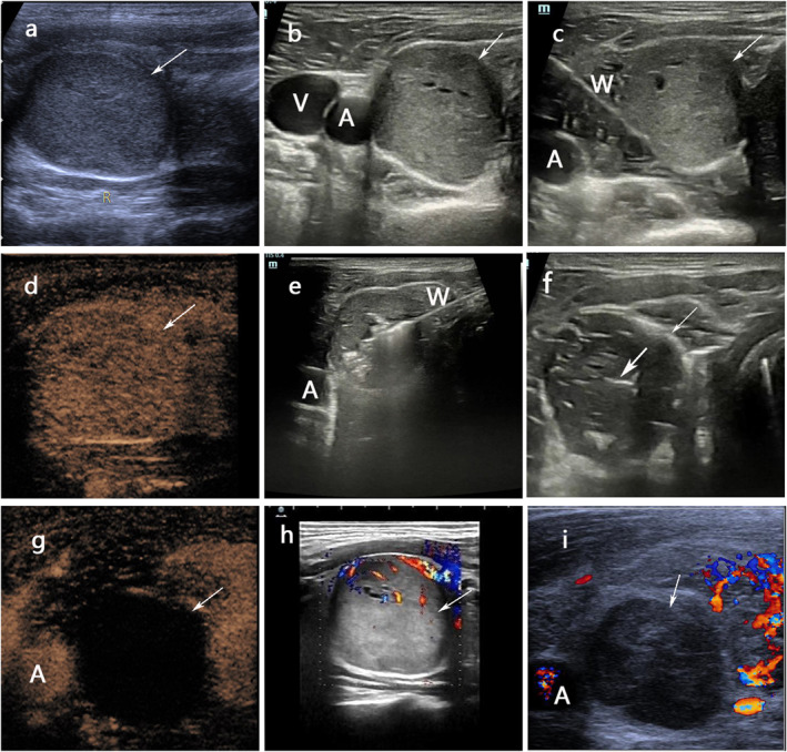 FIGURE 2