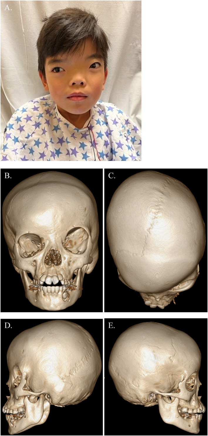 FIGURE 1