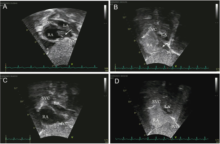 FIGURE 3