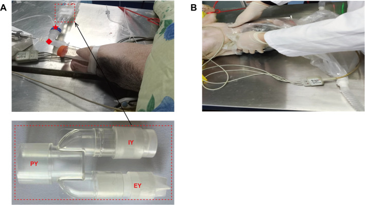 FIGURE 2