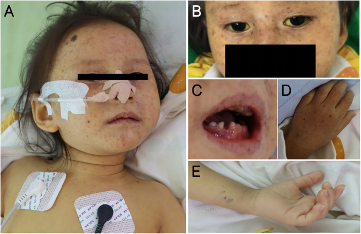 FIGURE 1