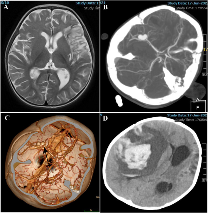FIGURE 4