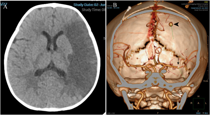FIGURE 1